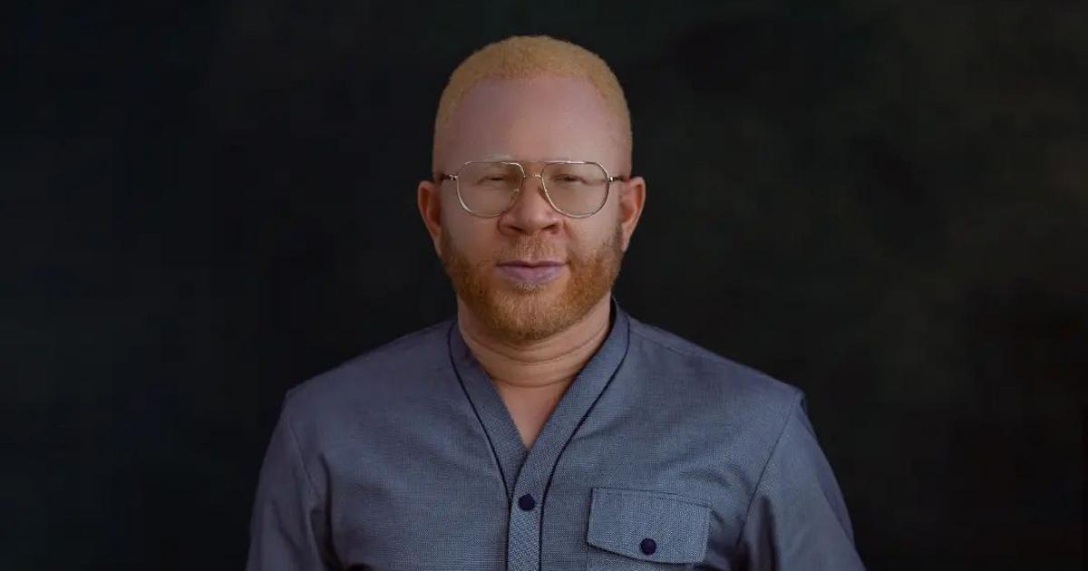 Damilola Ogunsi on facing discrimination in Nollywood for being an albino